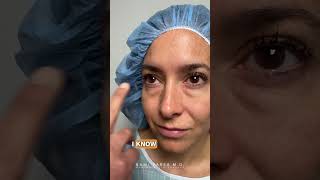 REACTION Trifecta Lift Results 6 Days PostOp  Dr Kami Parsa  Beverly Hills CA [upl. by Analart152]