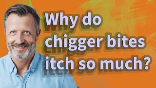 Why do chigger bites itch so much [upl. by Og934]