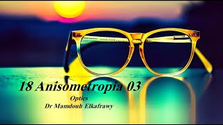 18 Anisometropia Part3 الكفراوي أوبتكس Elkafrawy optics Anisokonia Investigationamp Afocal lens [upl. by Nylirek]