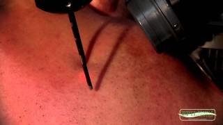 LASER DEPILAZIONE VISO Epilbeauty Tel 0541787808 [upl. by Airamas]