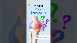 Plica Syndrome physiotherapy physicaltherapy knee kneepain [upl. by Adihsar]