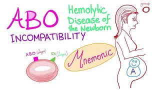 ABO incompatibility mnemonic [upl. by Woodcock]