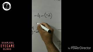 Retinoscopy 3  calculation [upl. by Cato]