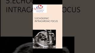 Echogenic intracardiac focus on antenatal scanwhat does it mean echogenicfocus heart [upl. by Christa220]