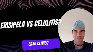 ERISIPELA VS CELULITIS [upl. by Nosrac]