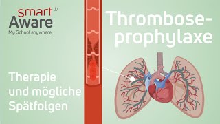 Thromboseprophylaxe Therapie und mögliche Spätfolgen  Fachfortbildungen in der Pflege  smartAware [upl. by Adiari]