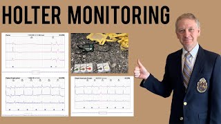 Holter Monitor  Everything you need to know [upl. by Anabella]