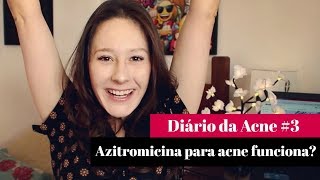 Antibiótico Azitromicina para ACNE  por Letícia Menezes [upl. by Virgilia]