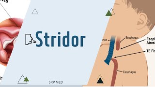 StridorDefinitionTypesMechanism [upl. by Airotna243]