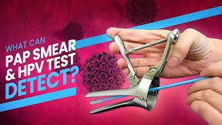 Pap Smear Pap Test and HPV Test  A step by step guide 3D at what happens during the test [upl. by Ogires908]