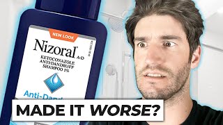 Nizoral Shampoo For Hair Loss  THE TRUTH [upl. by Assilev943]