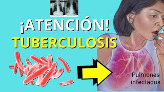 ✅TUBERCULOSIS PULMONAR🫁 Fisiopatología microbiologia signos y síntomas diagnóstico y tratamiento [upl. by Aiepoissac]