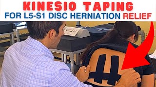 Kinesio Taping for L5S1 Herniated Disc L5S1 Disc Herniation  Dr Marc Dupuis Chiropractor [upl. by Nerval]