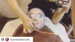 Silk Peel Facial  Yellow Laser Treatment at My Clinic amp Medispa [upl. by Aikcir]