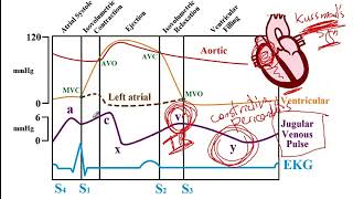 USMLE ACE Video 120 Wigger and FrankStarling Diagram [upl. by Asilim388]