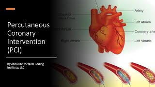 CPT Medicine Section Percutaneous Coronary Intervention PCI Coding [upl. by Dnomaj136]