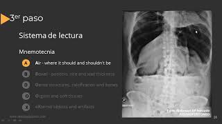 Radiografía de Abdomen Paso a Paso [upl. by Nwadahs]