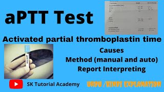 Activated partial thromboplastin time  aPTT test [upl. by Gausman400]