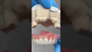 Fitting in the missing Anteriors ​⁠EnvisiontecMain envisiontec lsk121shorts dentist [upl. by Eemia]