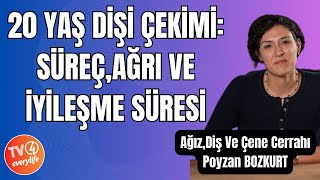 20 Yaş Dişi Çekimi Süreç Ağrı ve İyileşme Süresi [upl. by Jeremias]