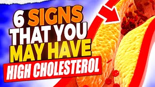 High Cholesterol Alert 6 Symptoms You Shouldnt Ignore [upl. by Etnahsa]