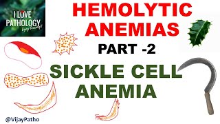 Hemolytic Anemias Part 2 SICKLE CELL ANEMIA Pathology [upl. by Gallard]