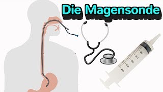 Alles wissenswerte zur Magensonde [upl. by Oned]