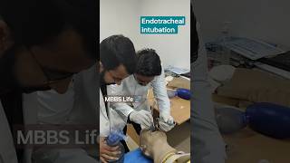 Intubation procedure endotracheal intubation shorts doctorslife medical mbbs [upl. by Uyr195]