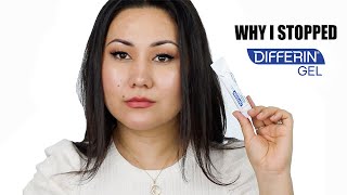 WHY I STOPPED USING DIFFERIN GEL  ADAPALENE GEL 01 ACNE TREATMENT  Zulayla [upl. by Cann]