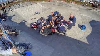 DAD BREAKS HIS LEG IN TWO PLACES AT SKATE PARK WITH FOUR KIDS [upl. by Rexer]