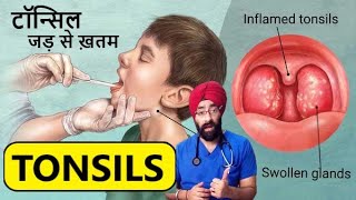 Understand TONSIL infection  टॉन्सिल्स के लक्षण बचाव और उपचार  DrEducation [upl. by Maurilia]