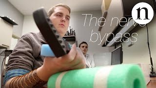 The nerve bypass how to move a paralysed hand [upl. by Alyar]