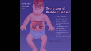 Krabbe disease [upl. by Ane834]