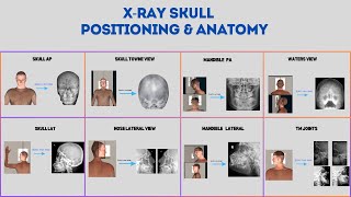 How to take skull xray positions and anatomy xrays xraytechnician skull skullandbones [upl. by Eelana]