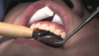 Aging and Cosmetic Dentistry [upl. by Alverson]