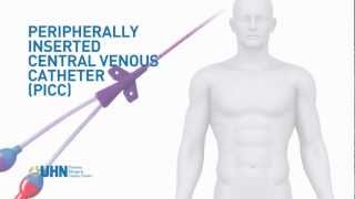 Learn About the Peripherally Inserted Central Venous Catheter PICC [upl. by Odnalor]