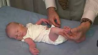 neurology exam newbornabnormal Primitive Reflexes  Grasp [upl. by Kliber]