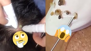 Ultimate Pimple Popping Compilation Prepare to Be Amazed [upl. by Ajnat]