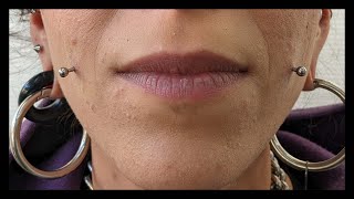 Cheek Piercing Procedure  SKART Lab TERNI [upl. by Lehmann]