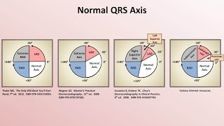 Intro to EKG Interpretation  Rate and Axis [upl. by Yllatan61]