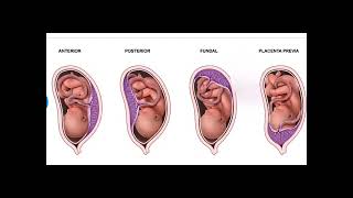 Anterior Placenta means baby Girl or Boy Posterior Placenta means baby Girl or Boy PlacentaPrevia [upl. by Enyamrahs637]