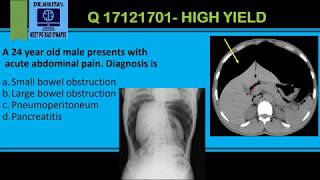 Pneumoperitoneum  CT Abdomen [upl. by Helsell]