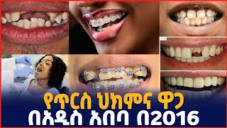 የጥርስ ህክምና በብድር እና በተመጣጣኝ ዋጋ በአዲስ አበባ 2016 ብሬስ Dental clinic in Addis Ababa brace Silebusiness [upl. by Archambault]