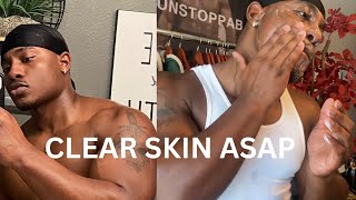 How To Get Clear Skin For Guys [upl. by Clyde]