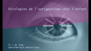 Etiologies de lastigmatisme chez lenfant [upl. by Anderer]