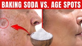 BAKING SODA permanently remove AGE SKIN SPOTS Do this [upl. by Ecinhoj]