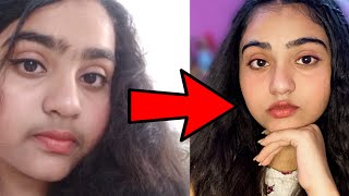 Teenage Facial Hair Removal with total Natural Ingredients How I removed my Facial Hairs Naturally [upl. by Tiphanie283]