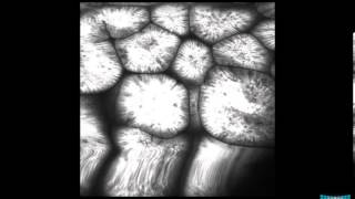 Confocal Endomicroscopy of the Stomach Gastritis Int Metaplasia Adenoma and Gastric Cancer [upl. by Einahpts]