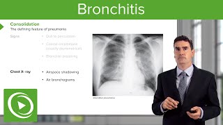 Pneumonia Introduction amp Types – Respiratory Medicine  Lecturio [upl. by Desdamonna]