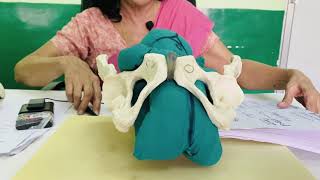 OBSTETRICS Breech Presentation 11 B Mechanism of Labour by Dr Rekha Sapkal [upl. by Amuh435]